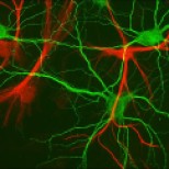 Hippocampal neurons and glial cells
